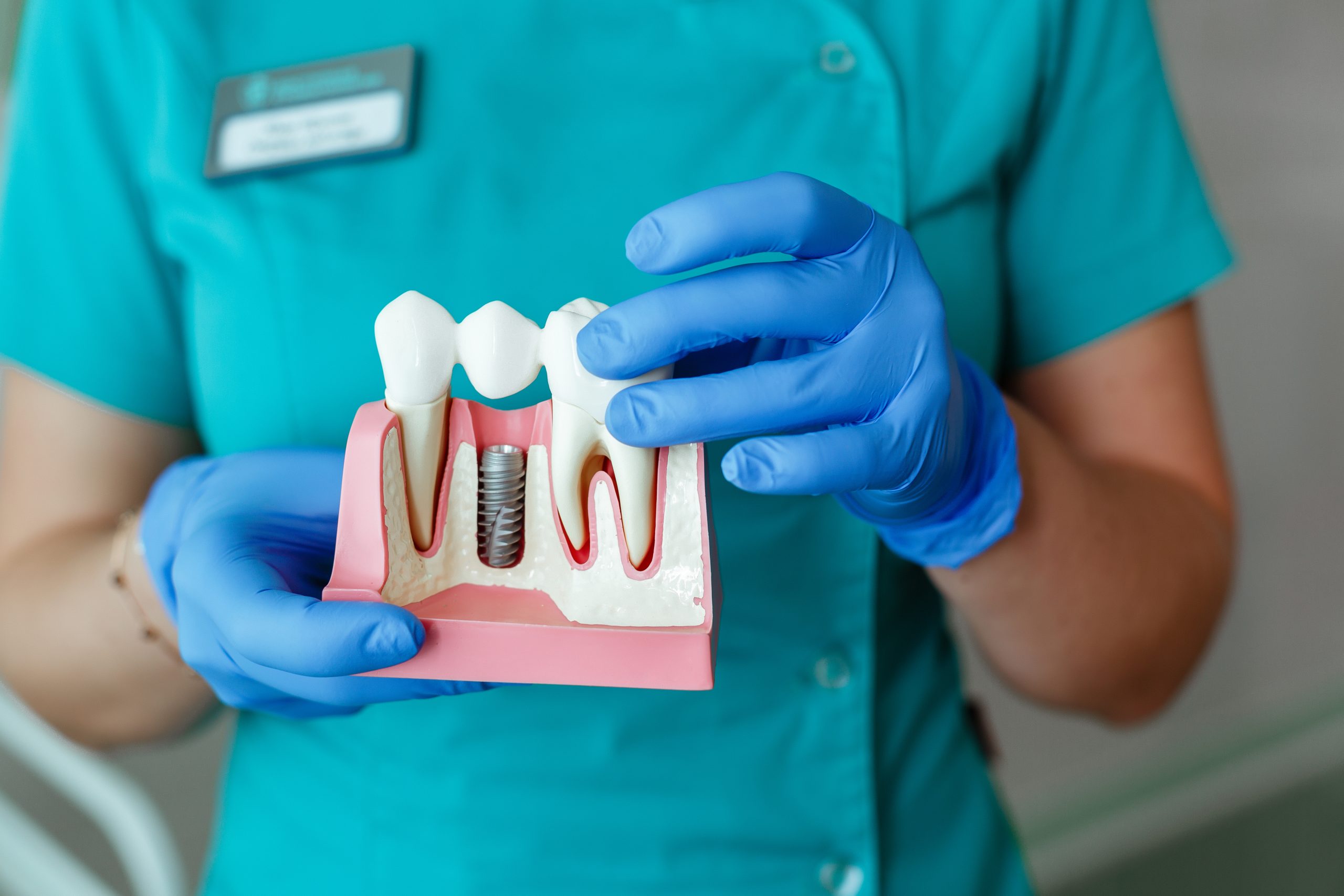 Monrovia Dental Implants
