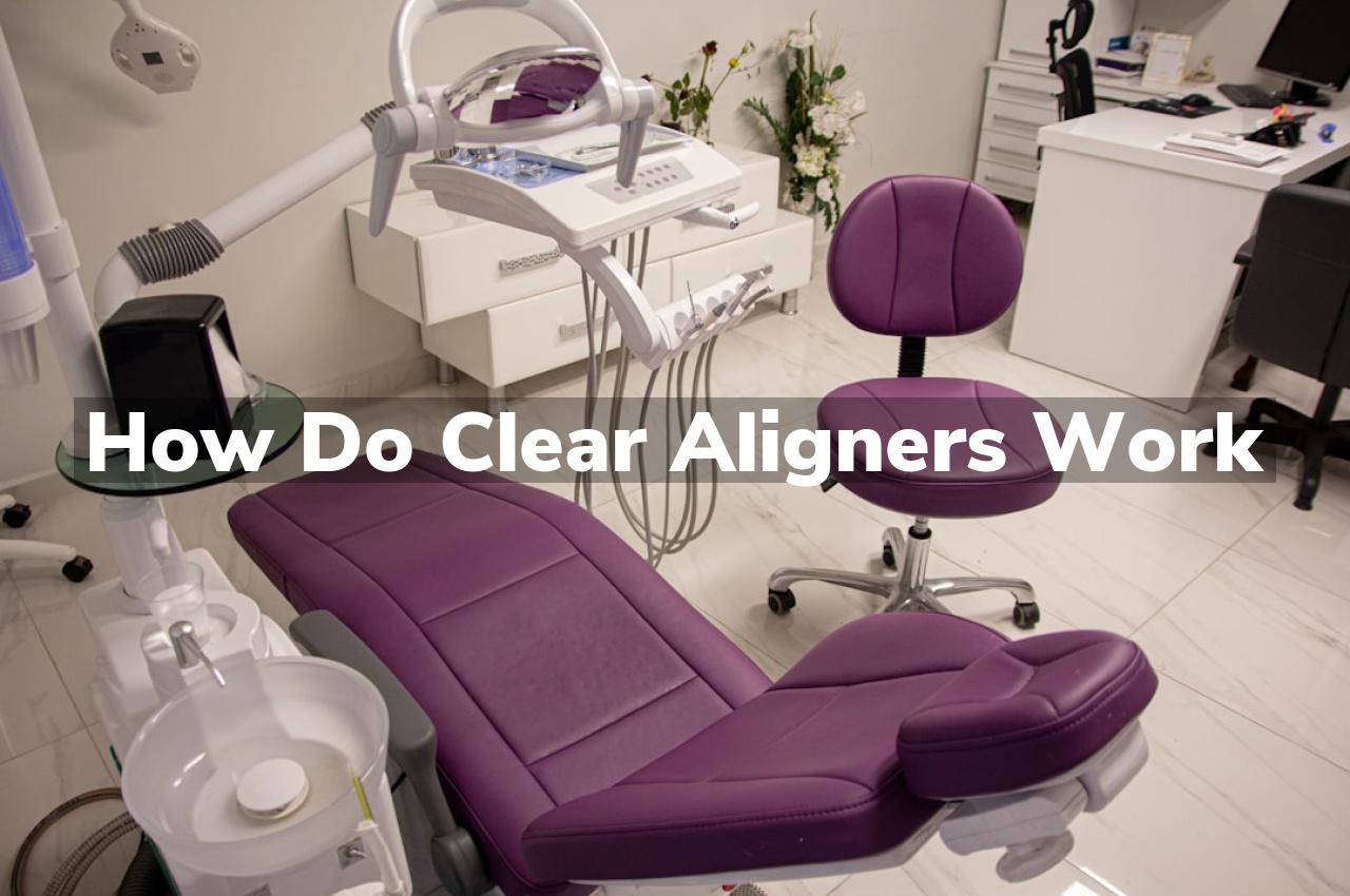 How Do Clear Aligners Work