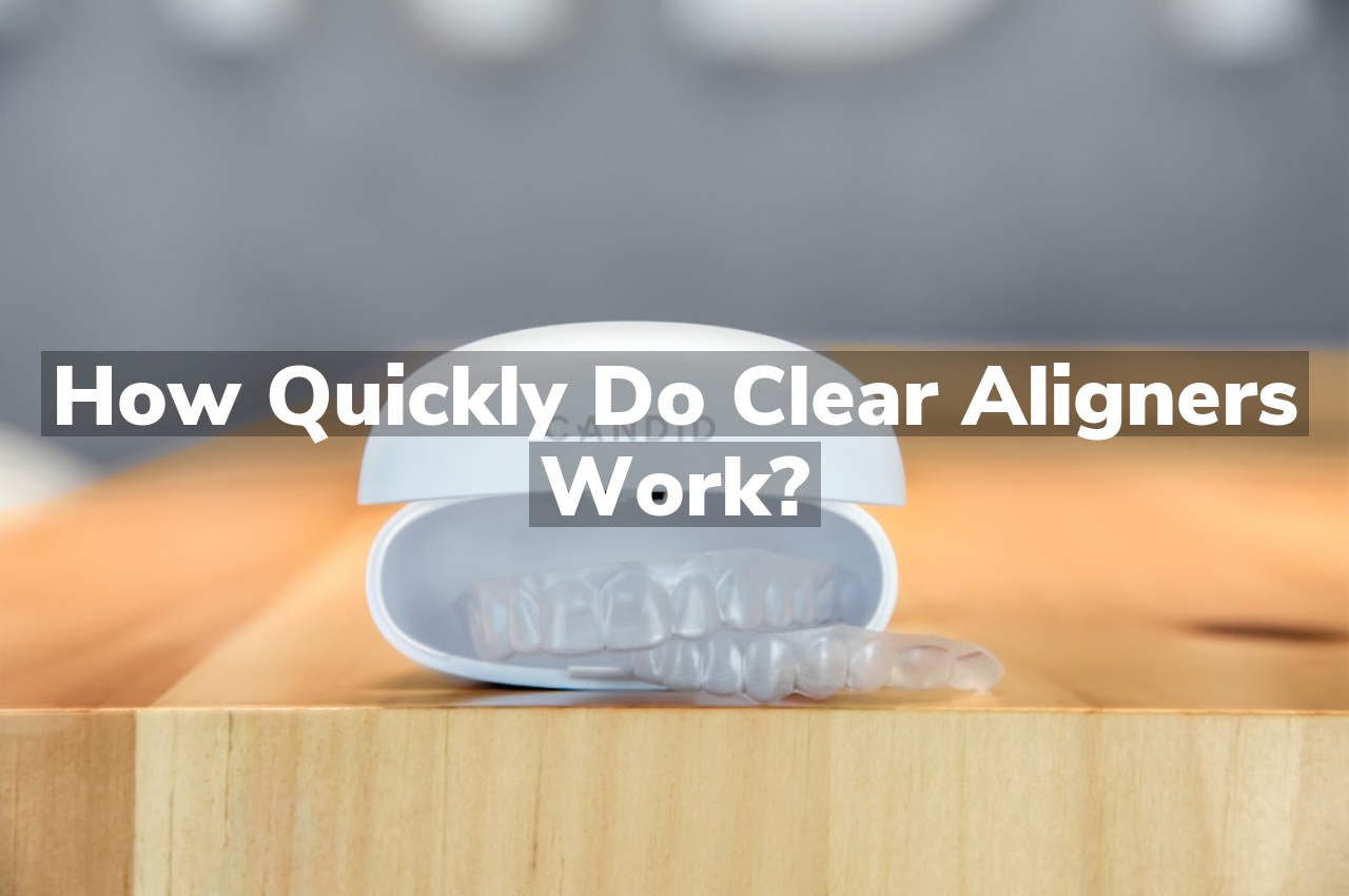 How Quickly Do Clear Aligners Work?